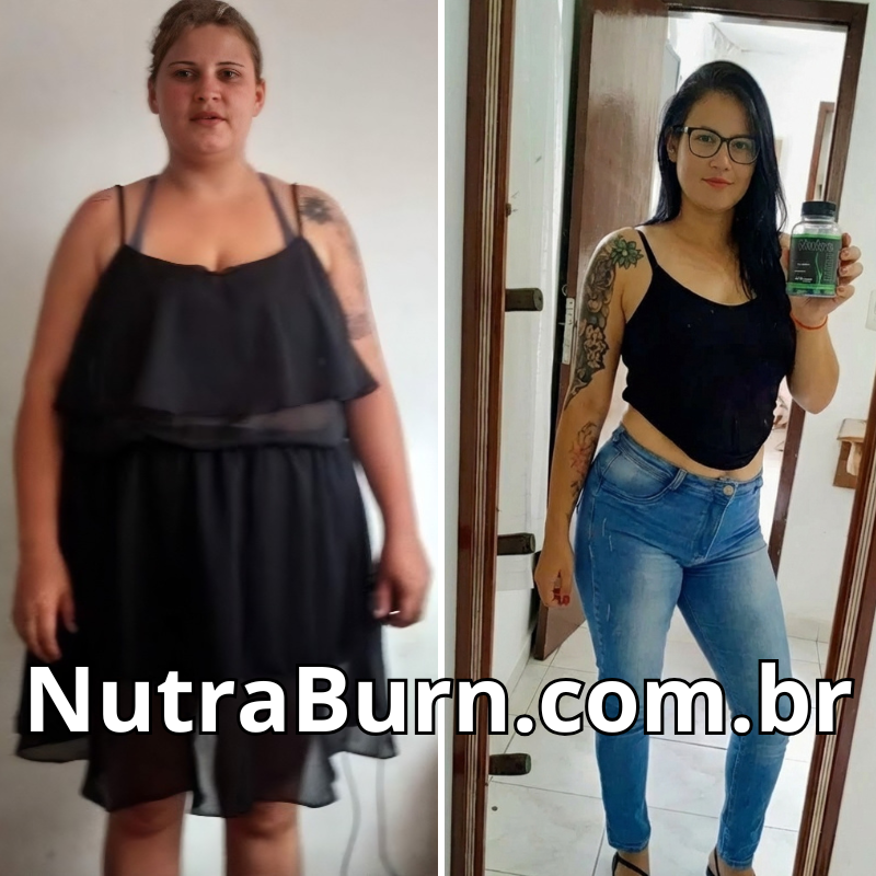 antes e depois de emagrecer (1)