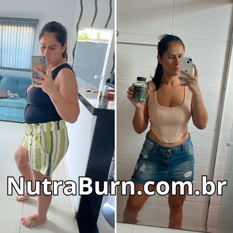 antes e depois de emagrecer (7)